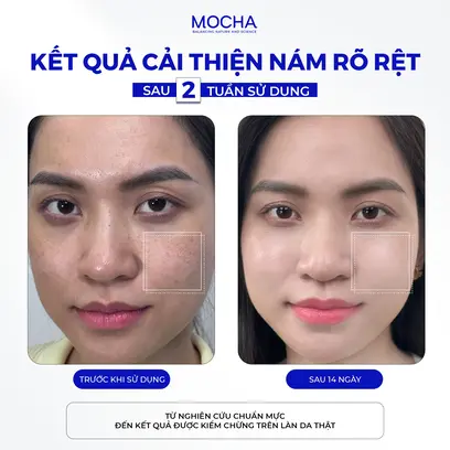 Thành phần thiên nhiên