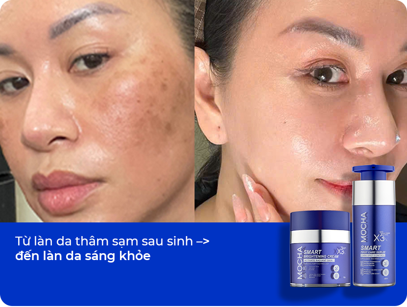 Da sáng khỏe sau sinh