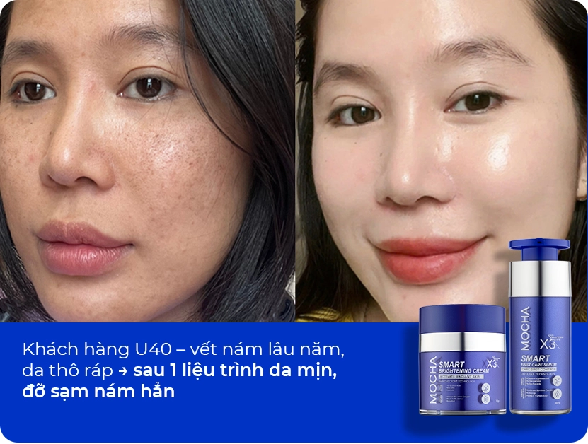 Xóa bỏ nỗi lo của U40